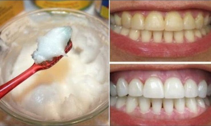 Cum să realizezi albirea dinţilor în 30 zile cu ingrediente naturale