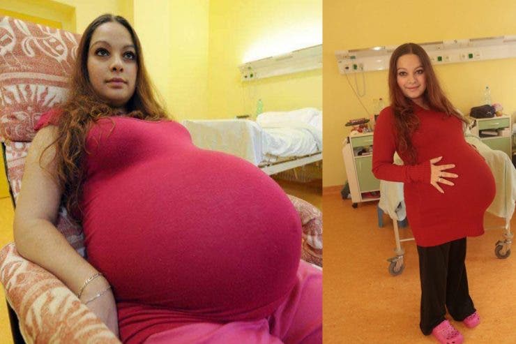 40 de medici au asistat-o la naștere. Câți copii a putut să nască