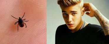Ce este boala Lyme, cum apare, cum se manifesta. Justin Bieber a dezvăluit că suferă de boala Lyme