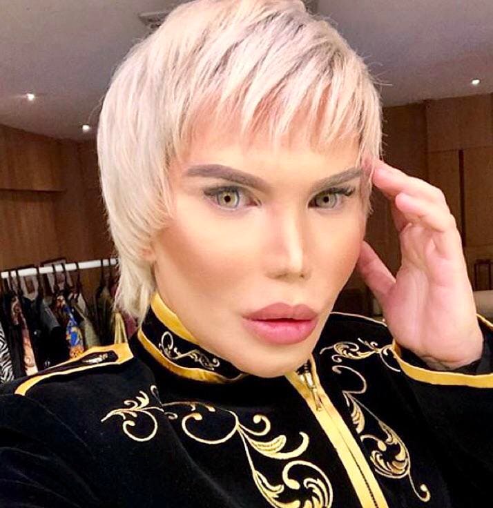 Păpușa umană Ken este nerecunoscut! Rodrigo Alves a investit un milion de dolari pe operațiile estetice