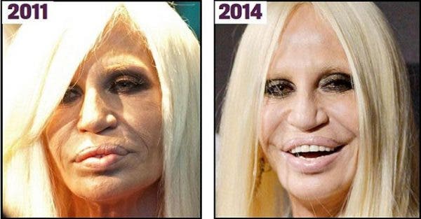 Donatella Versace este total schimbată! Cum au transformat-o operațiile estetice de-a lungul anilor