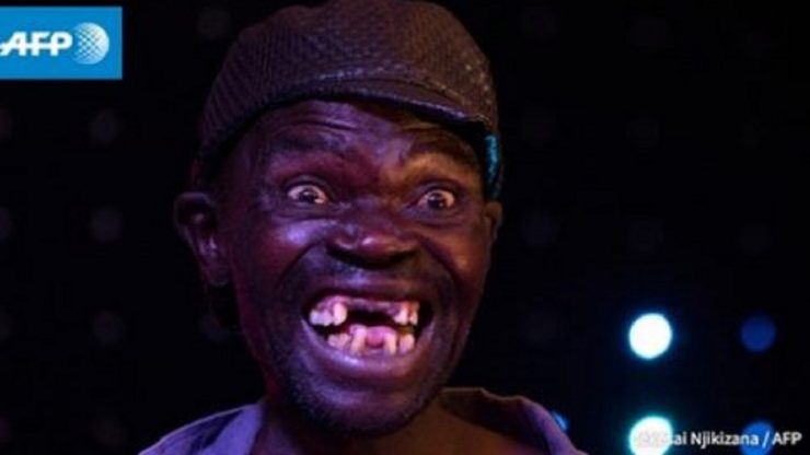 A fost declarat cel mai urât bărbat din țara lui. Rivalii s-au revoltat, pe motiv că e prea frumos 25 cel mai urat barbat din Zimbabwe