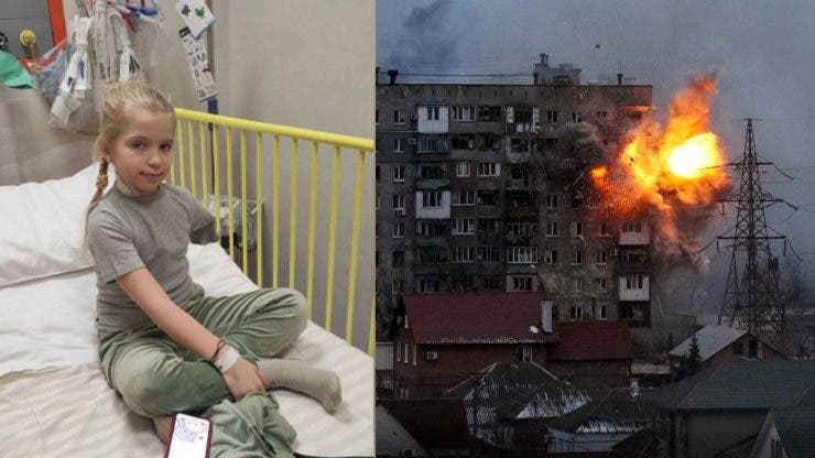Mesajul emoționant al unei fetițe rămase fără braț, după ce a fost împușcată de armata rusă Sper că nu au vrut să mă rănească