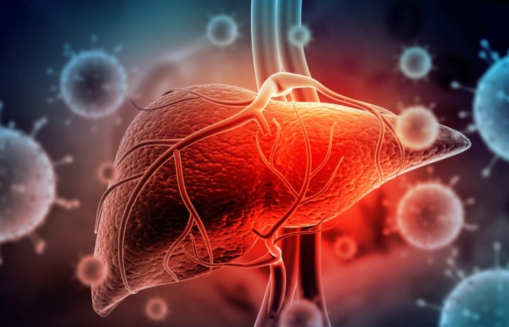Steatoza hepatica poate fi vindecata. Afla CUM! 25