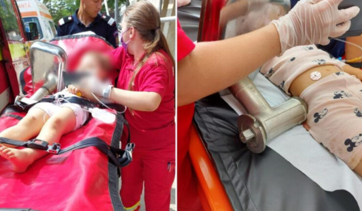 O fetiță de doar patru ani și-a prins mâna într-un tocător electric. Cum a înfruntat copila intervenția medicilor 25