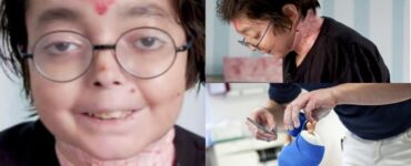 Băiatul cu „piele de fluture”: orice mișcare e un pericol pentru viața lui. Trebuia să trăiască doar trei zile, iar azi are 16 ani