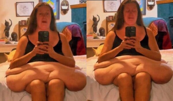 O femeie care a cântărit 600 de kg cândva a publicat un clip video cu excesul de piele rămas: „Îmi atârnă până la genunchi”