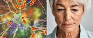 Semnul timpuriu al demenței care te va pune pe gânduri! Aceste persoane pot suferi de boala Alzheimer