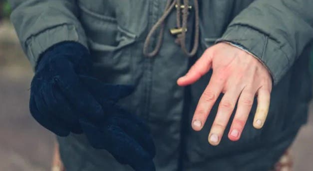 Culoare neobișnuită a degetelor de la mâini, după ce te expui la frig. Ce înseamnă aceste semne ale corpului