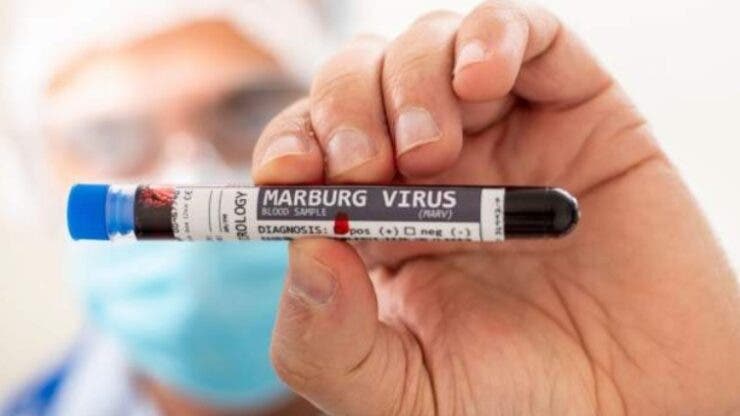 Ce este virusul Marburg, din cauza căruia nouă oameni au decedat deja! Virusul are o rată a mortalității de până la 88%