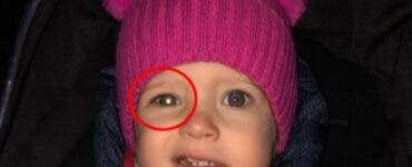 O femeie a văzut ceva ciudat în ochiul fetiței ei și a dus-o la medic, crezând că are nevoie de ochelari. Ce avea copila de trei ani, de fapt