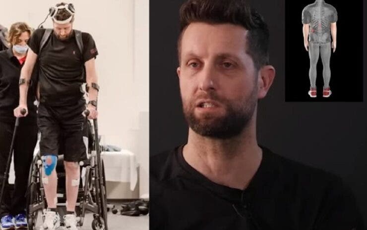 Un bărbatul paralizat de peste 10 ani merge din nou! După un tragic accident de motocicletă nici nu visa la acest progres medical VIDEO