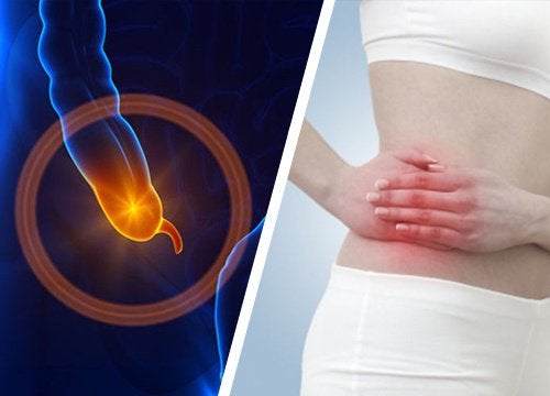 Testul în 5 pași care te va ajuta să verifici dacă ai apendicită. Cum recunoaștem simptomele 26 Test care te ajuta să descoperi apendicita
