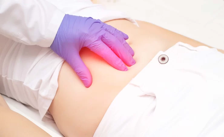 Testul în 5 pași care te va ajuta să verifici dacă ai apendicită. Cum recunoaștem simptomele 25 apandicita