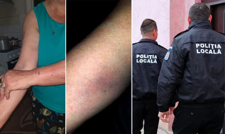 Doi bunici, bruscați și agresați de doi polițiști locali. Scenele s-au petrecut chiar sub ochii nepoțica de zece ani 25