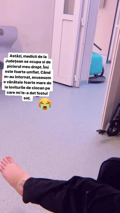 Dana Roba este internată din nou în spital. În ce stare se află, de fapt, femeia: ”Este foarte umflat” 26 dana roba internata