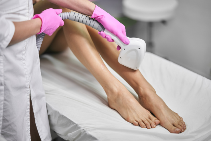Epilarea definitivă: ce trebuie să știi înainte să o încerci? 25