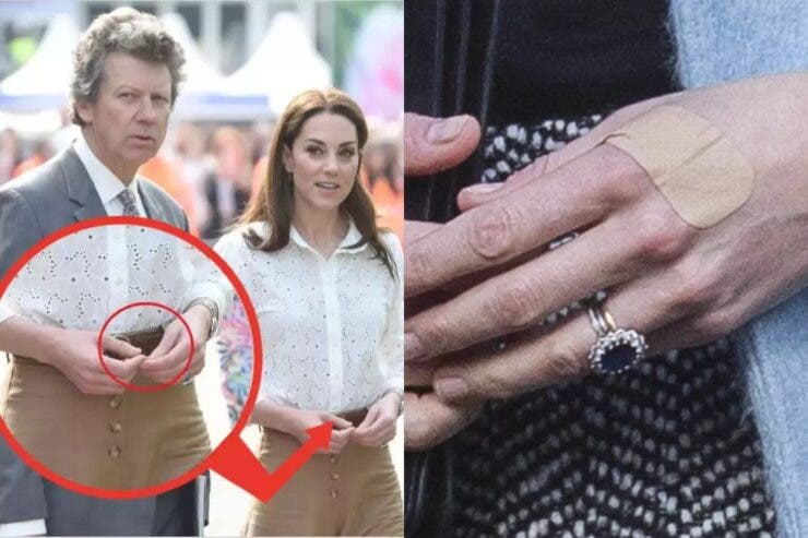 De ce are Kate Middleton degetele bandajate?!