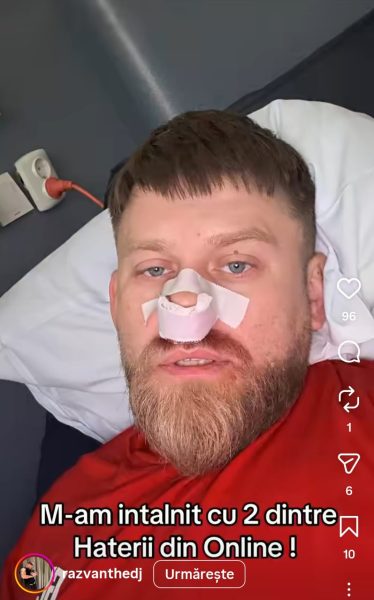 Răzvan Kovacs a ajuns pe mâinile medicilor după despărțirea de Ema. La ce intervenție a fost supus 26 Răzvan Kovacs