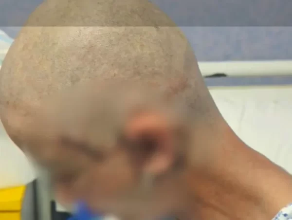Cine este femeia care se află în moarte cerebrală după o intervenție estetică la București. Familia acuză medicul 26 moarte cerebrala