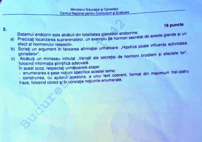 Subiecte Anatomie Bacalaureat 2026. Elevii au scris un minieseu despre variațiile secreției hormonilor tiroidieni și efectele acestora